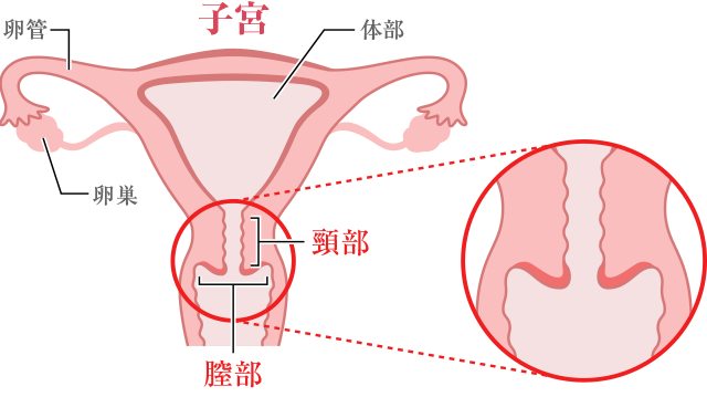 レーザー蒸散術