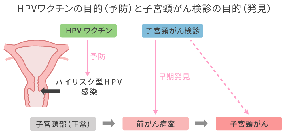 HPVワクチンの目的（予防）と子宮頸がん検診の目的（発見）