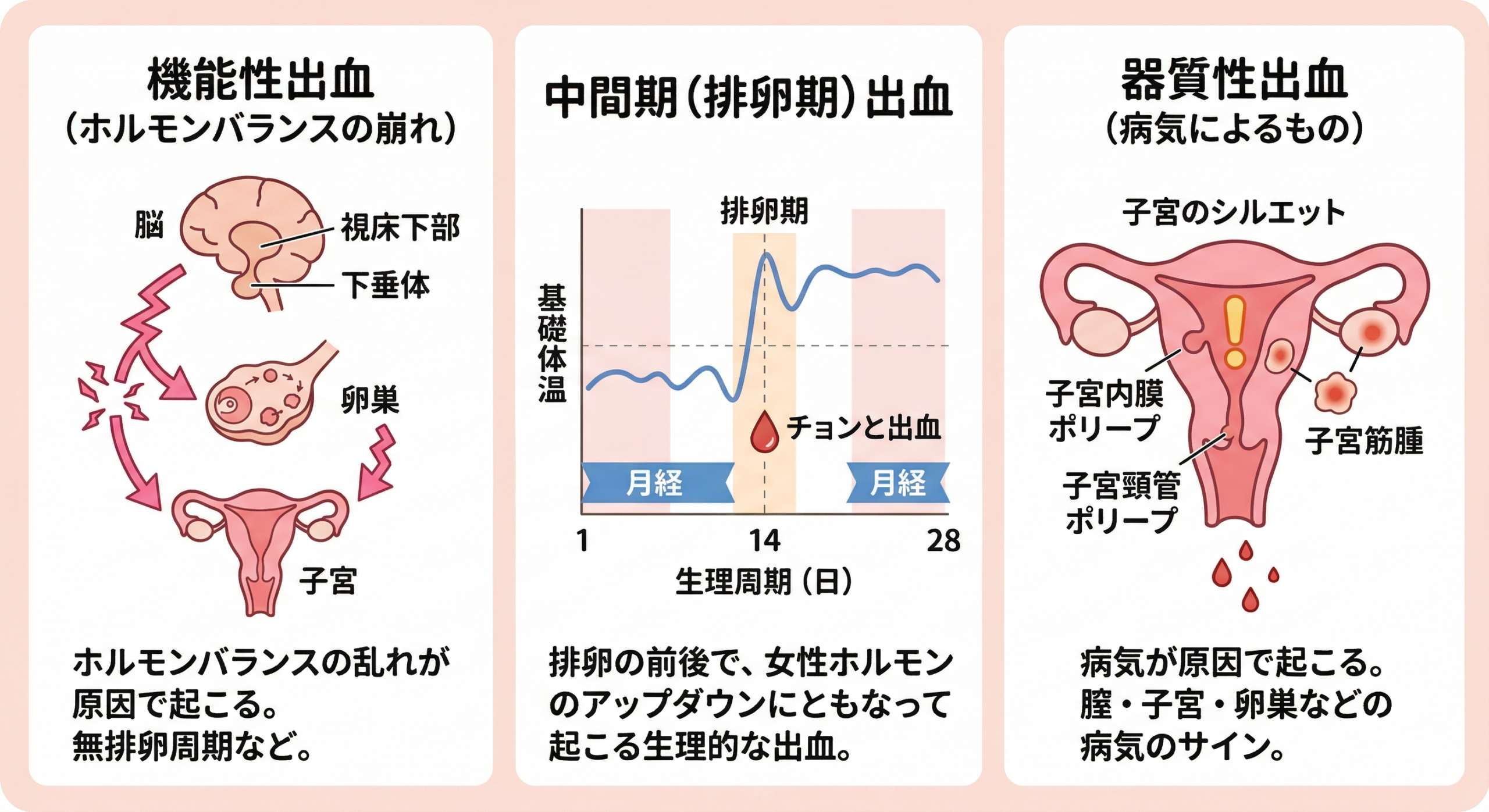 不正出血の分類（機能性・中間期・器質性）