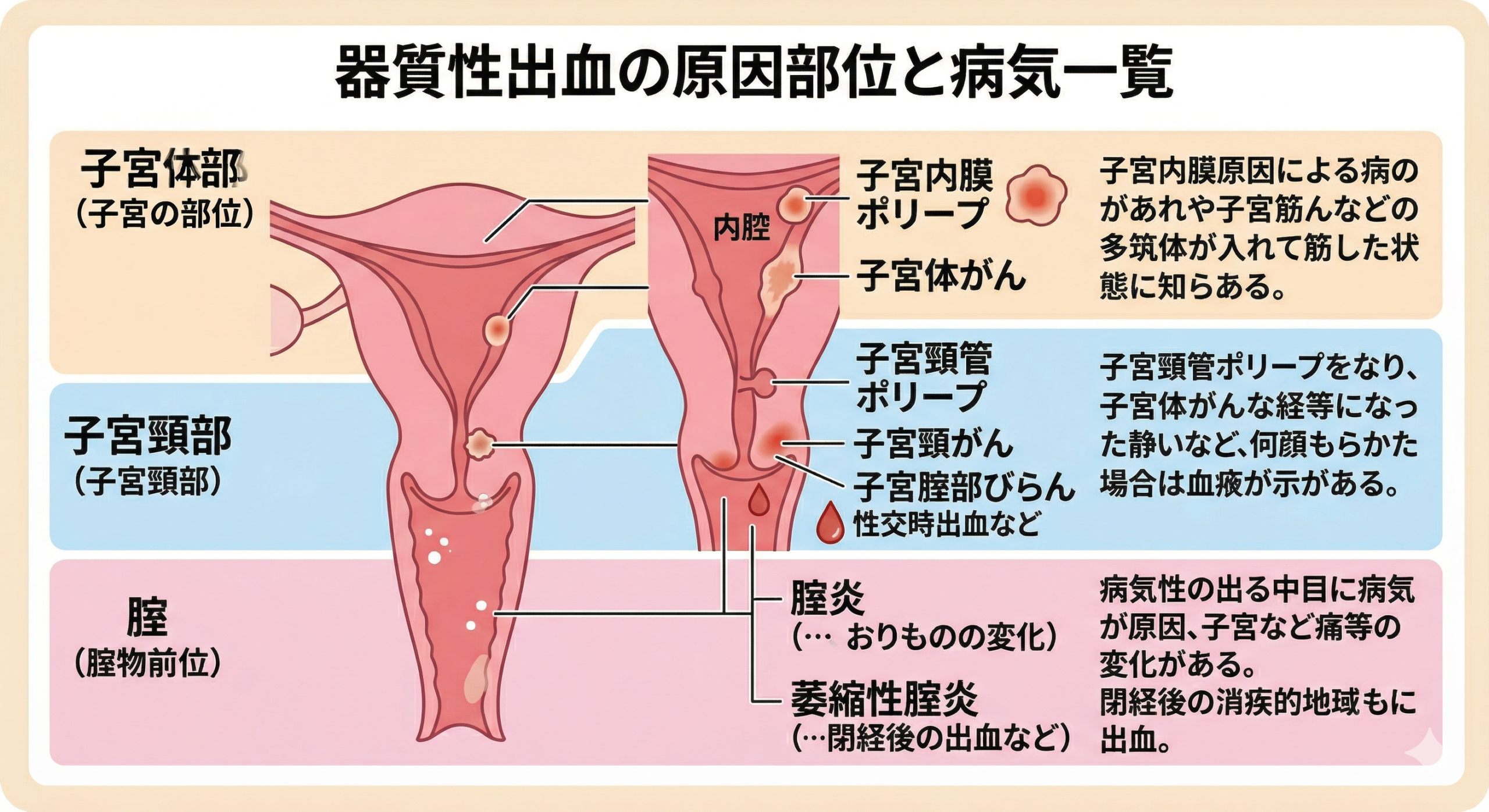 器質性出血の原因部位